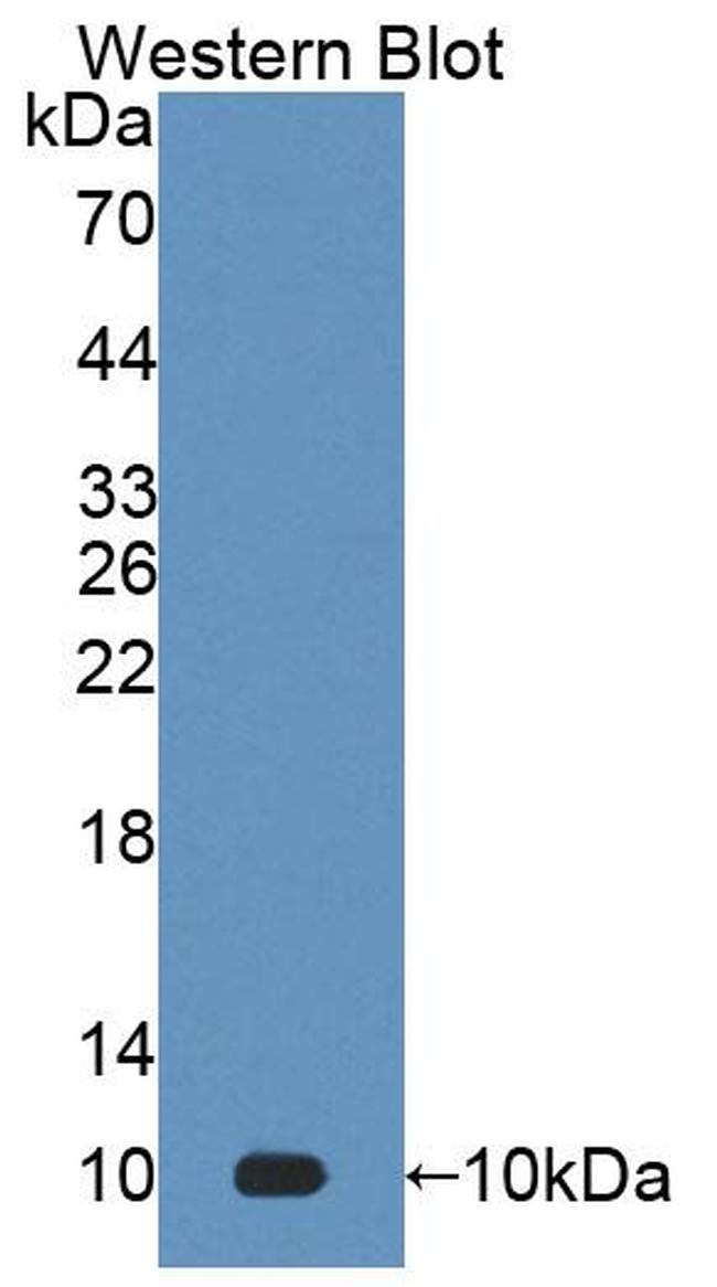 S100A7 Antibody in Western Blot (WB)