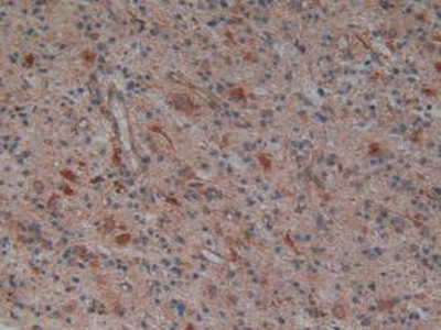 PLAA Antibody in Immunohistochemistry (Paraffin) (IHC (P))