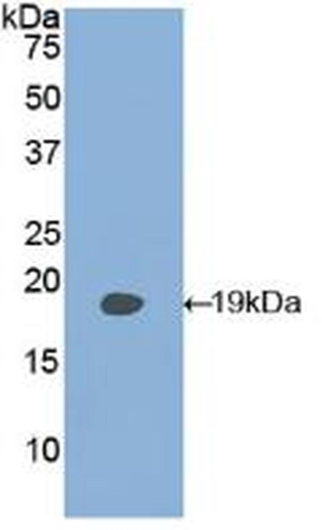 PLAA Antibody in Western Blot (WB)