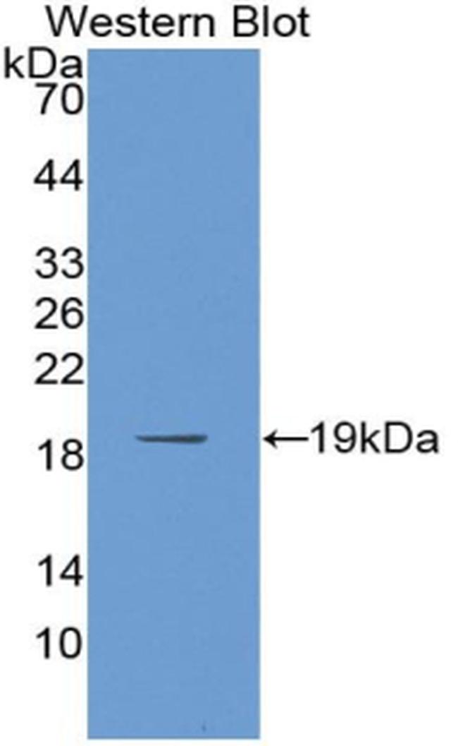 PABPC1L Antibody in Western Blot (WB)