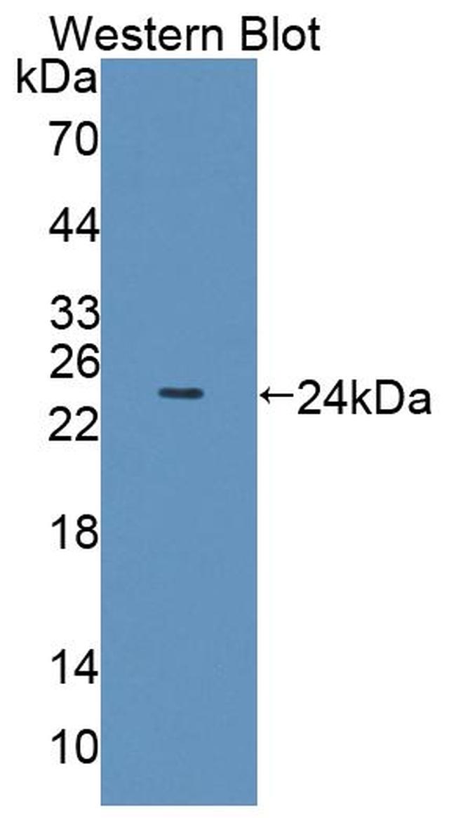 OLFM3 Antibody in Western Blot (WB)