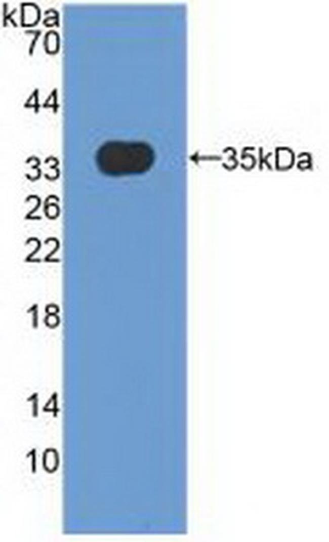 MXRA5 Antibody in Western Blot (WB)