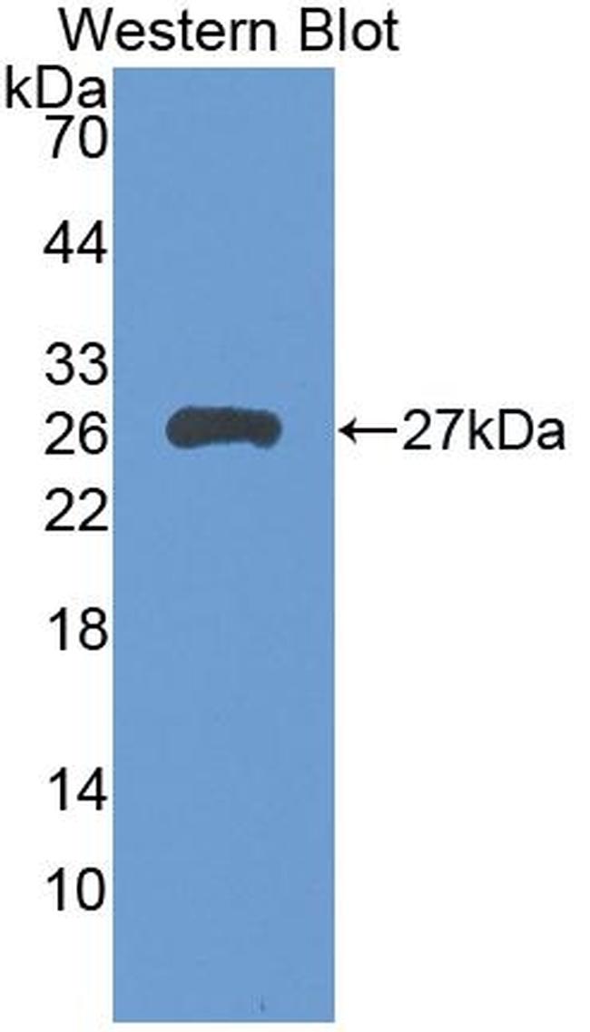 LILRB3 Antibody in Western Blot (WB)