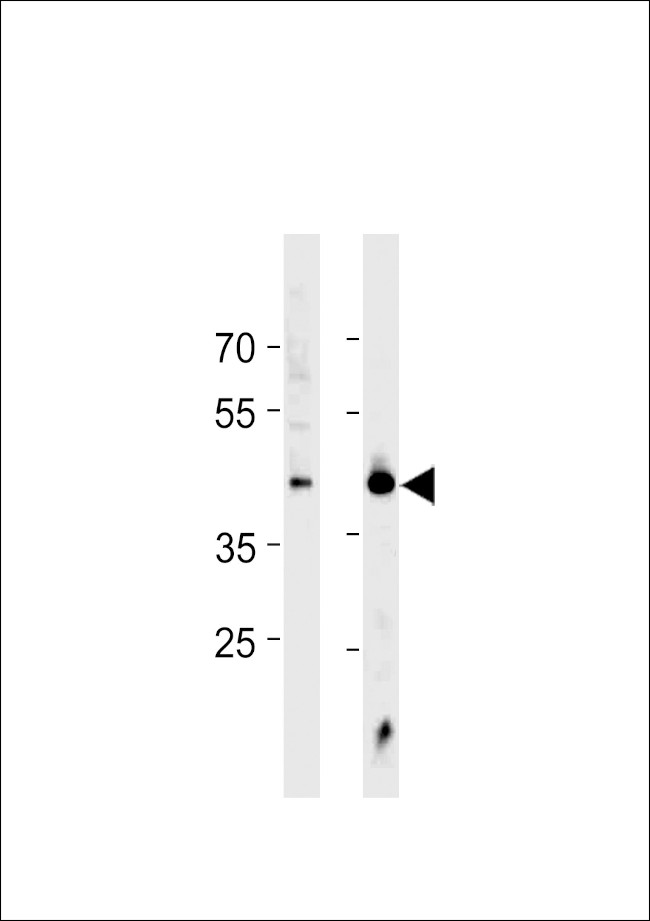 HSF1 Antibody in Western Blot (WB)