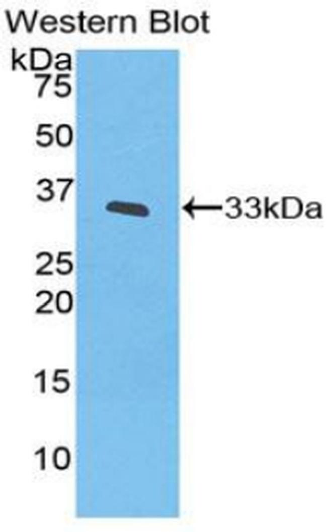 IL20RB Antibody in Western Blot (WB)