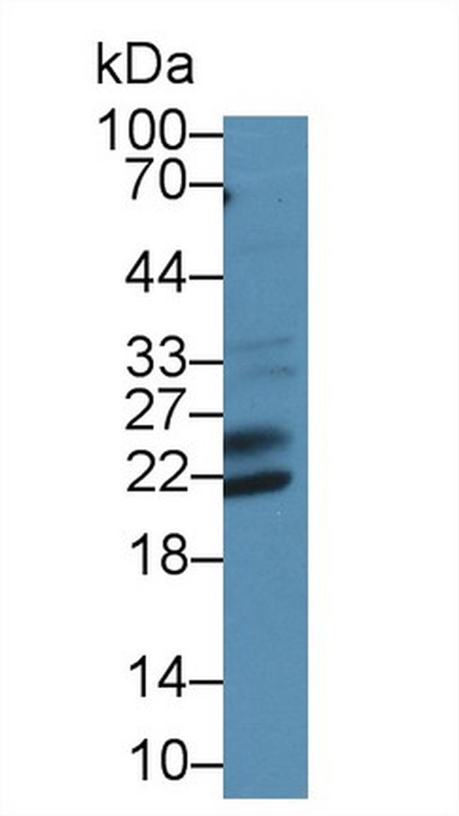 SHISA4 Antibody in Western Blot (WB)