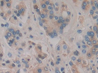 HPR Antibody in Immunohistochemistry (Paraffin) (IHC (P))