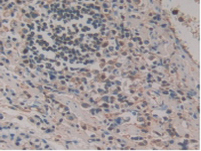 HPR Antibody in Immunohistochemistry (Paraffin) (IHC (P))