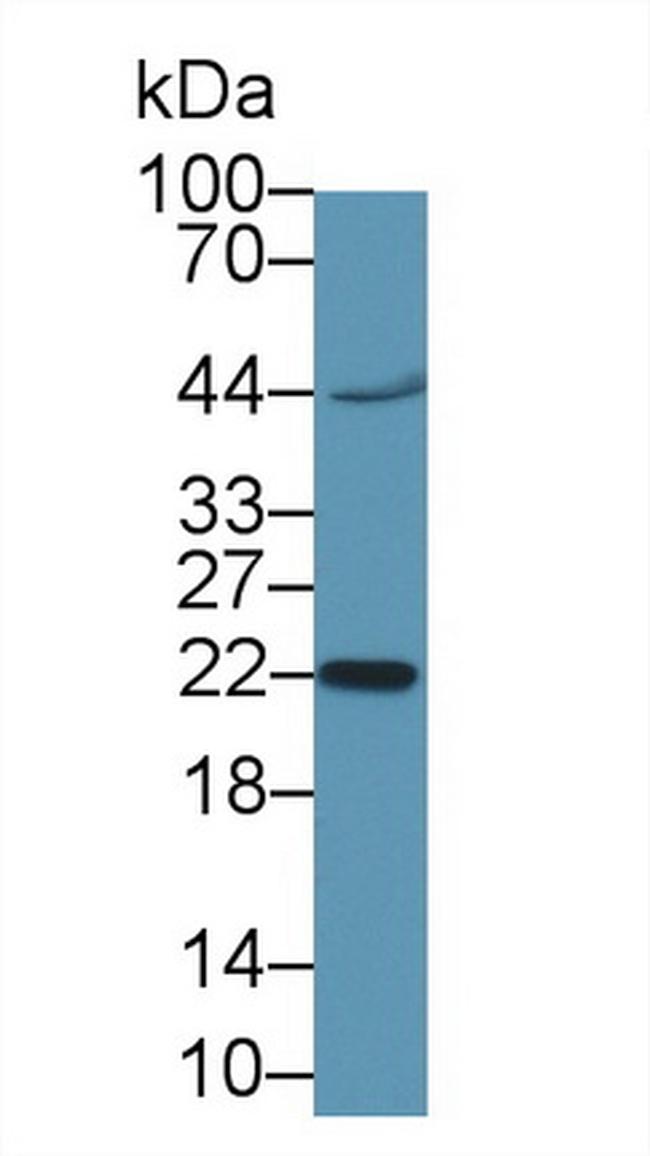 hCG beta-1 Antibody in Western Blot (WB)