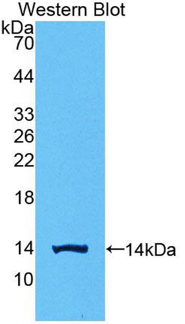 hCG beta-1 Antibody in Western Blot (WB)