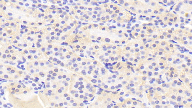 Gtf2h5 Antibody in Immunohistochemistry (Paraffin) (IHC (P))