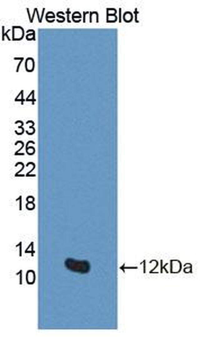 Gtf2h5 Antibody in Western Blot (WB)