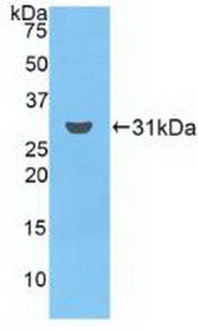 Ficolin 3 Antibody in Western Blot (WB)