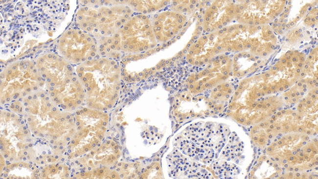 FGF23 Antibody in Immunohistochemistry (Paraffin) (IHC (P))