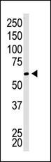 CBX4 Antibody in Western Blot (WB)