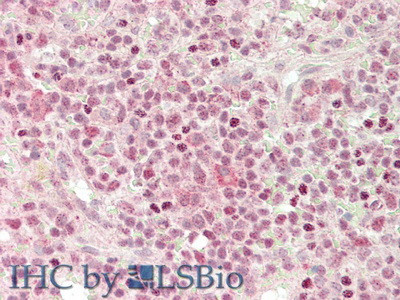 CXCL2 Antibody in Immunohistochemistry (Paraffin) (IHC (P))