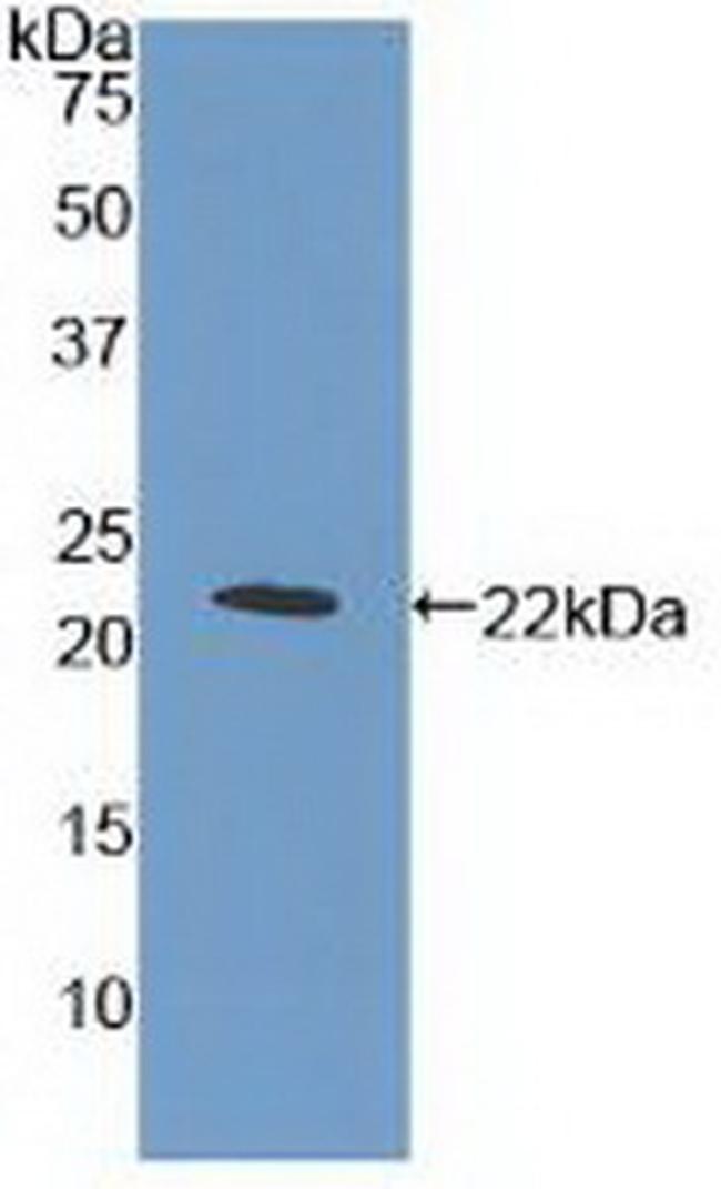 c-Mpl Antibody in Western Blot (WB)