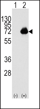 ACOX1 Antibody in Western Blot (WB)