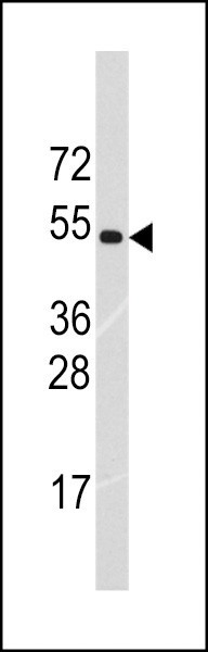 RNF36 Antibody in Western Blot (WB)