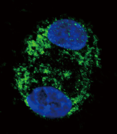 CPT2 Antibody in Immunocytochemistry (ICC/IF)