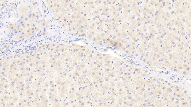 cGAS Antibody in Immunohistochemistry (Paraffin) (IHC (P))