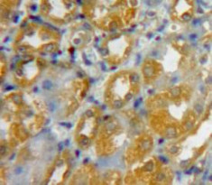 beta-3 Defensin Antibody in Immunohistochemistry (Paraffin) (IHC (P))