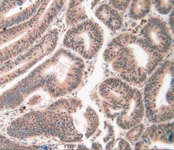 ATP7B Antibody in Immunohistochemistry (Paraffin) (IHC (P))