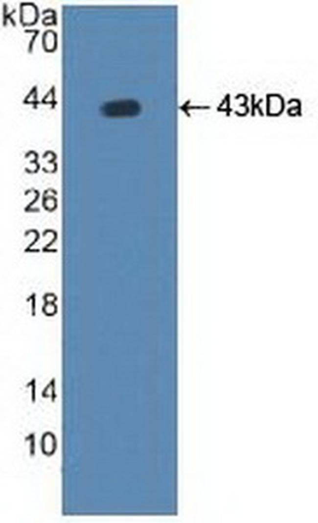 ATP7B Antibody in Western Blot (WB)