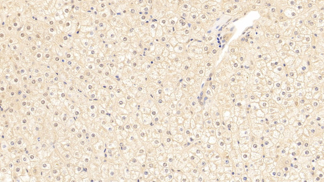 SERPINA3 Antibody in Immunohistochemistry (Paraffin) (IHC (P))