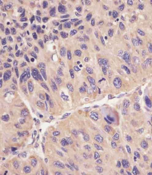 ACSL4 Antibody in Immunohistochemistry (Paraffin) (IHC (P))