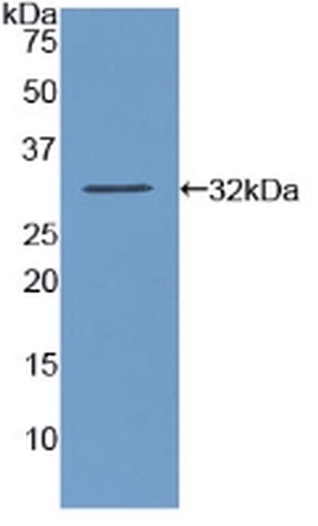 Amylase alpha Antibody in Western Blot (WB)