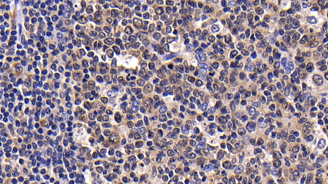 CXCL13 Antibody in Immunohistochemistry (Paraffin) (IHC (P))