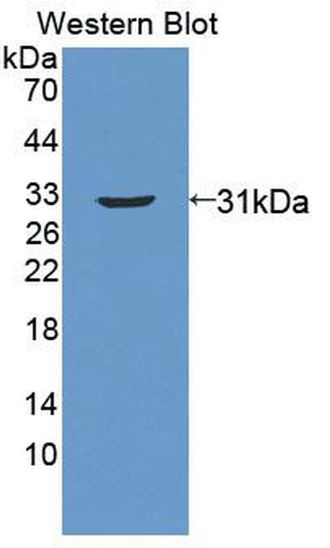 ABCC11 Antibody in Western Blot (WB)