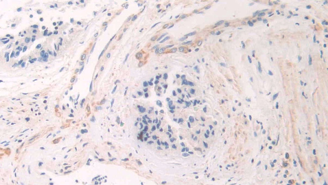 A26C2 Antibody in Immunohistochemistry (Paraffin) (IHC (P))