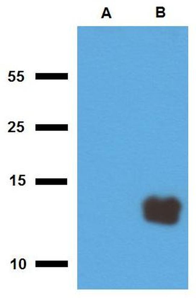 Mycobacterium tuberculosis Tb10.3 Antibody in Western Blot (WB)