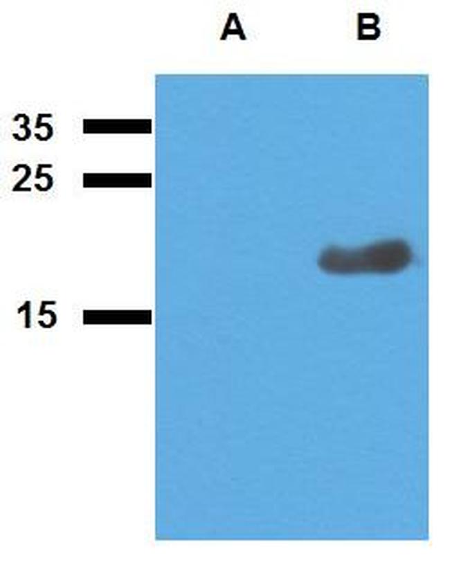 Mycobacterium tuberculosis Acr2 Antibody in Western Blot (WB)