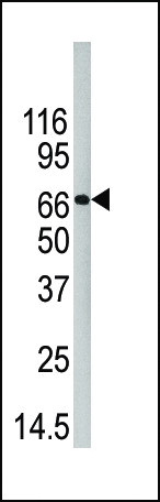 PADI4 Antibody in Western Blot (WB)