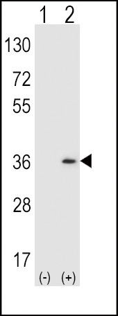 SULT1A1 Antibody in Western Blot (WB)