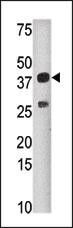 SULT1C2 Antibody in Western Blot (WB)