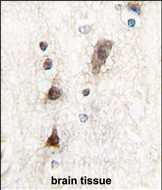 PTF1A Antibody in Immunohistochemistry (Paraffin) (IHC (P))