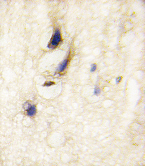 DAAM1 Antibody in Immunohistochemistry (Paraffin) (IHC (P))