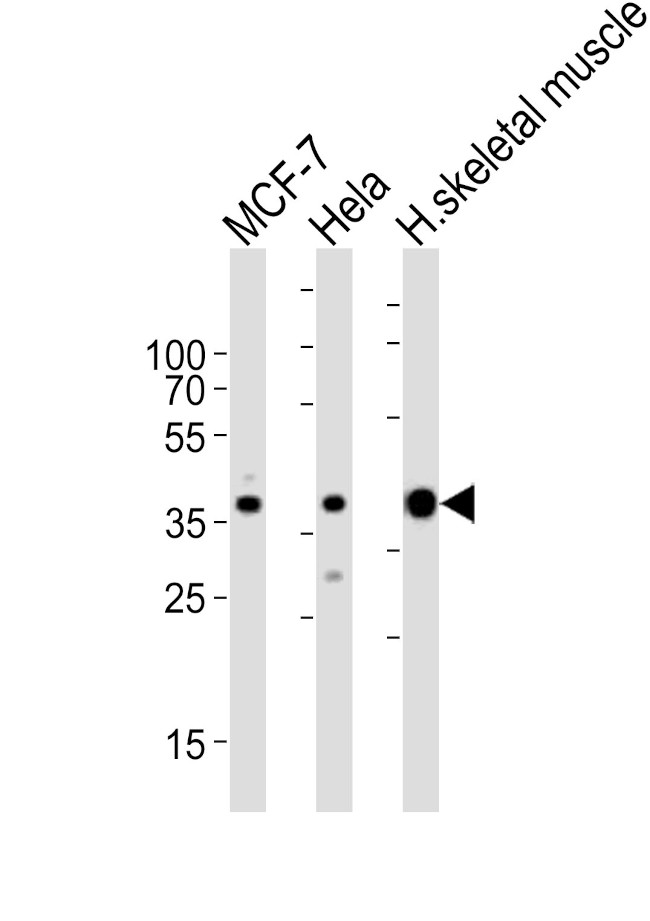 Aldolase A Antibody in Western Blot (WB)