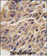 IDO Antibody in Immunohistochemistry (Paraffin) (IHC (P))