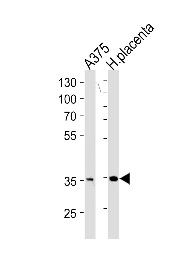 AKR1B1 Antibody in Western Blot (WB)