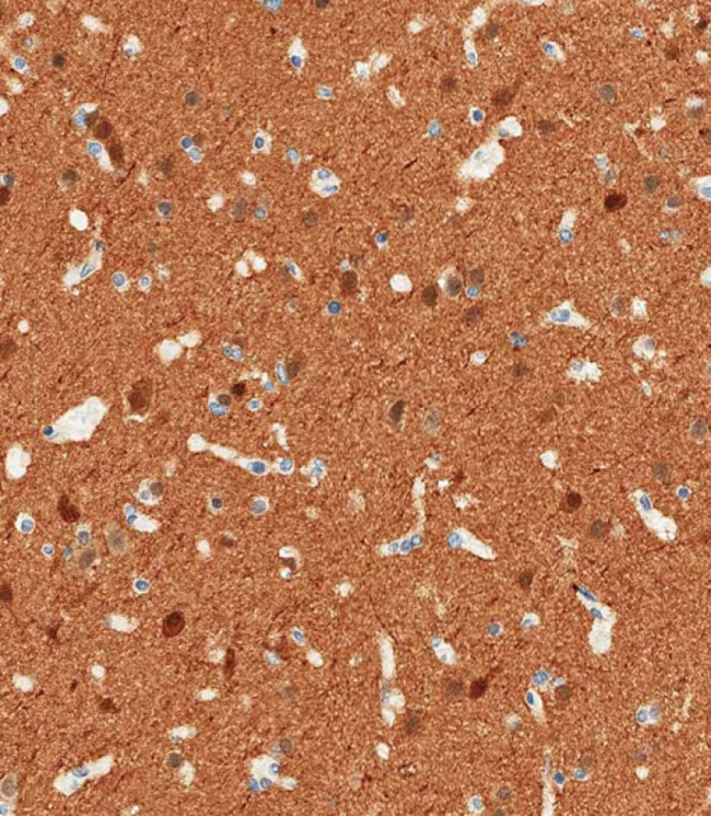 NSE Antibody in Immunohistochemistry (Paraffin) (IHC (P))