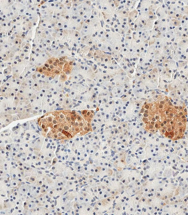 NSE Antibody in Immunohistochemistry (Paraffin) (IHC (P))