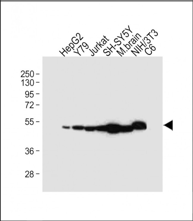 NSE Antibody in Western Blot (WB)