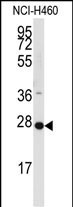 PPAP2C Antibody in Western Blot (WB)