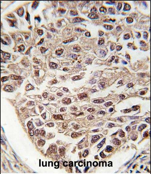 SRSF2 Antibody in Immunohistochemistry (Paraffin) (IHC (P))