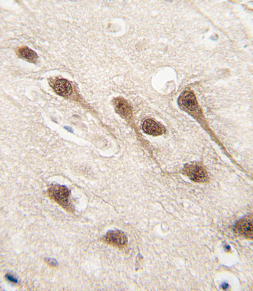 RUNX1 Antibody in Immunohistochemistry (Paraffin) (IHC (P))